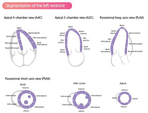 17 segments of left ventricle.